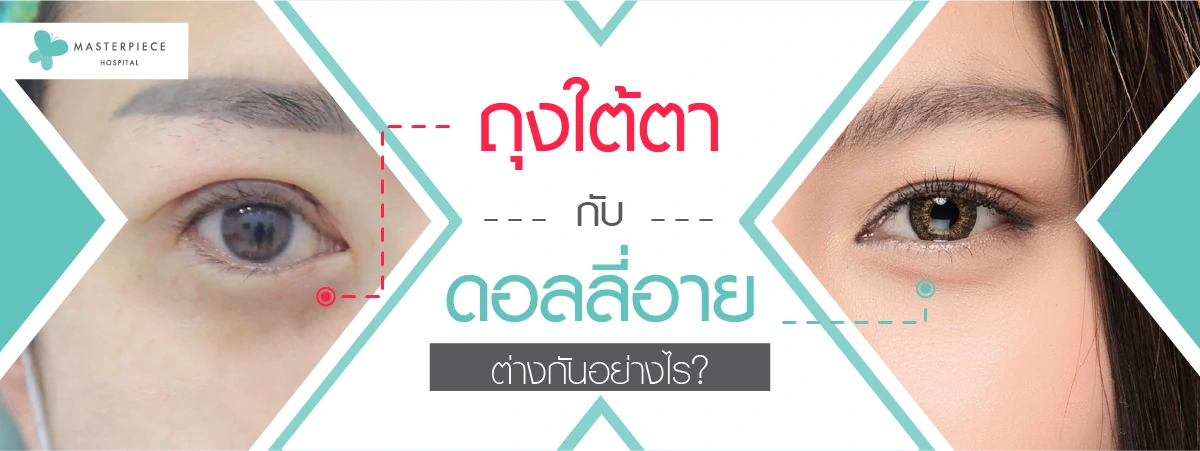 ถุงใต้ตากับดอลลี่อายต่างกันอย่างไร