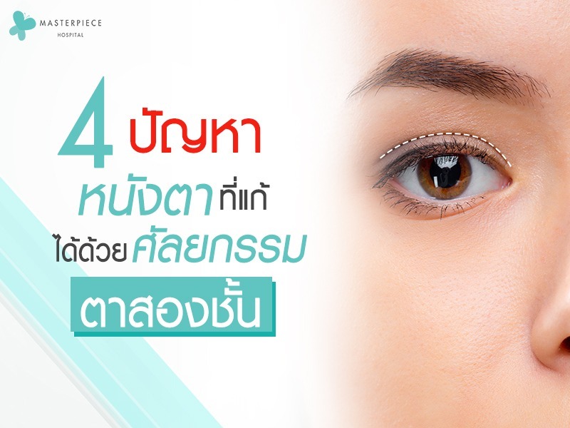 4 ปัญหาหนังตา-ที่แก้ได้ด้วยศัลยกรรมตาสองชั้น